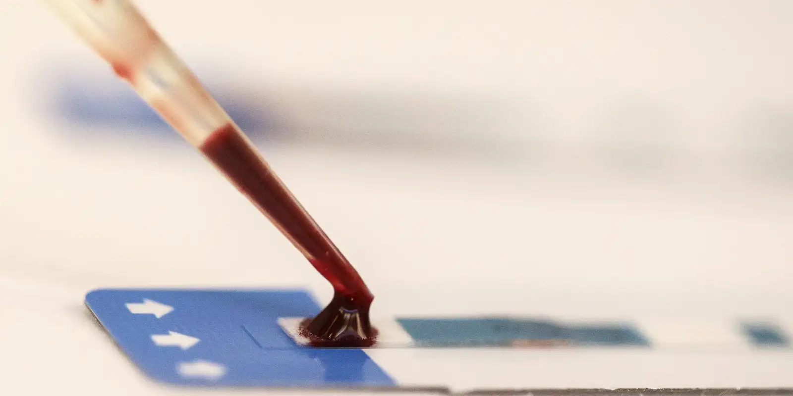 Estudo inédito da Fiocruz pode ampliar prevenção de HIV entre jovens